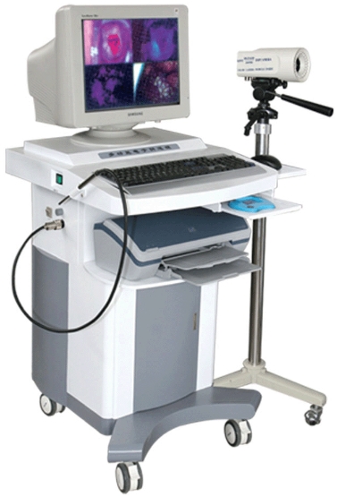 電子陰道鏡：女性健康，私密檢查的得力助手