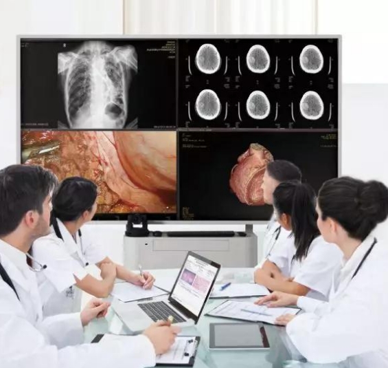 遠程醫(yī)療影像會診：跨越地域的醫(yī)療智慧共享