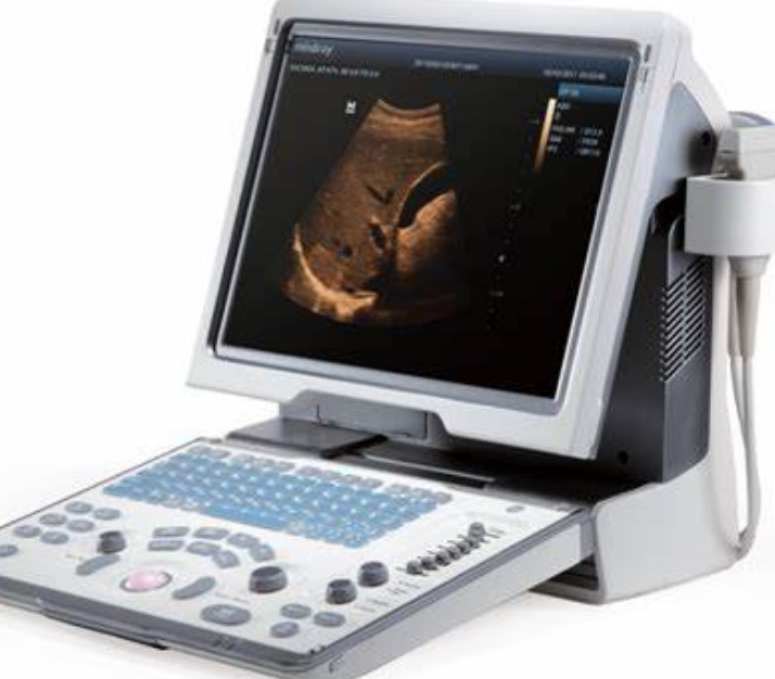 超聲診斷的便攜化革命：隨時(shí)隨地，精準(zhǔn)醫(yī)療觸手可及