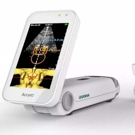 超聲引導(dǎo)穿刺的智能化：精準定位，提升手術(shù)安全性