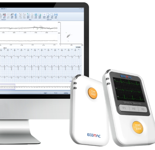 遠(yuǎn)程心電監(jiān)測(cè)的智能化：精準(zhǔn)分析，守護(hù)心臟健康