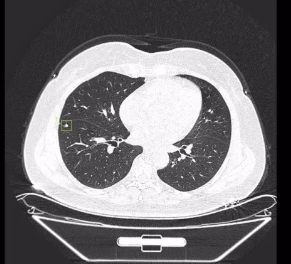 透視生命，洞悉健康：詳解醫(yī)學(xué)影像處理軟件的革新應(yīng)用