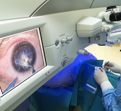 科技守護視力：探索最新全飛秒激光近視矯正技術(shù)的突破