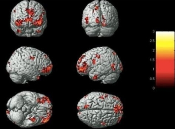 守護(hù)健康，從‘腦’開始：揭秘新一代腦功能成像技術(shù)的革新