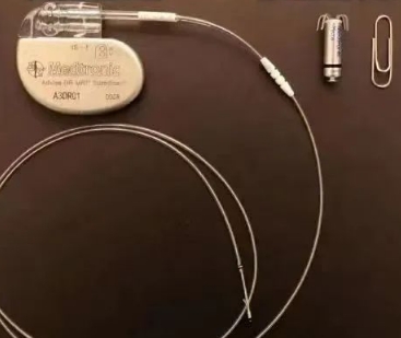 心臟再同步治療的新時(shí)代：雙心室起搏器的技術(shù)進(jìn)步與臨床效果