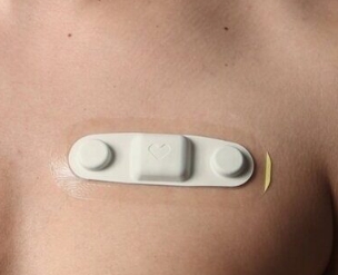 無創(chuàng)心臟監(jiān)測的新突破：可穿戴心電圖貼片的技術(shù)特點與應(yīng)用場景