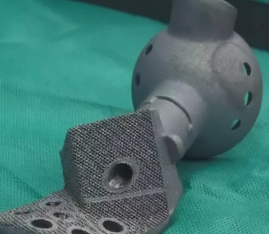 個(gè)性化骨科修復(fù)的未來(lái)：3D打印定制化關(guān)節(jié)假體的應(yīng)用與發(fā)展