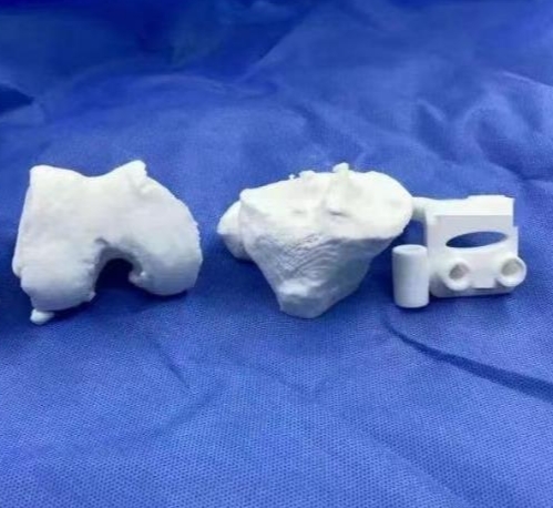 個性化骨科治療的創(chuàng)新：3D打印定制化骨板的應(yīng)用與發(fā)展