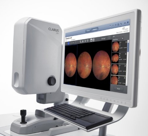 精準(zhǔn)眼科診斷的未來(lái)：超廣角眼底血管成像系統(tǒng)的臨床應(yīng)用與優(yōu)勢(shì)