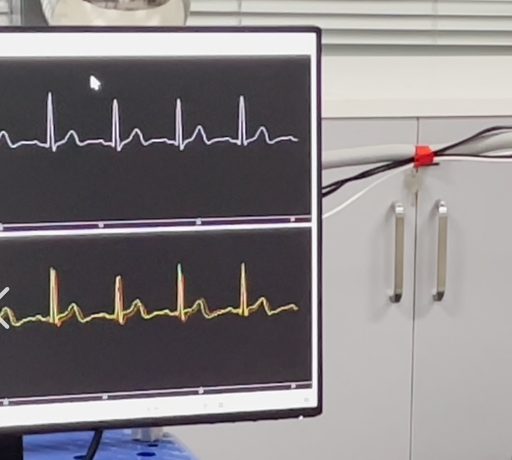 無創(chuàng)心臟監(jiān)測新工具：穿戴式心沖擊圖（BCG）設(shè)備全天候監(jiān)控心臟健康