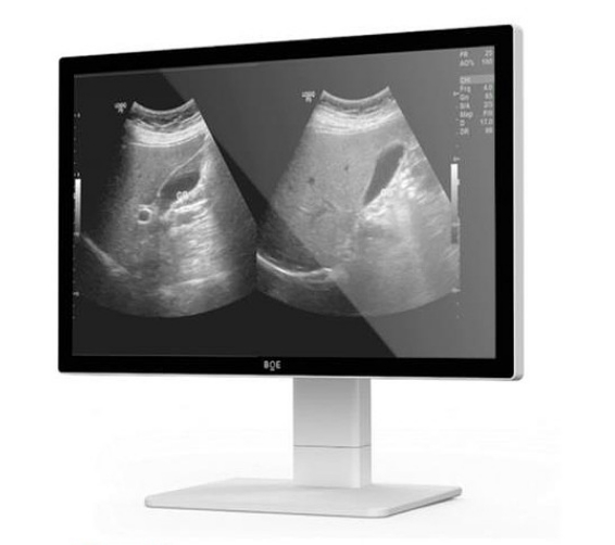 AI輔助診斷系統(tǒng)提高疾病檢測的準確性和速度