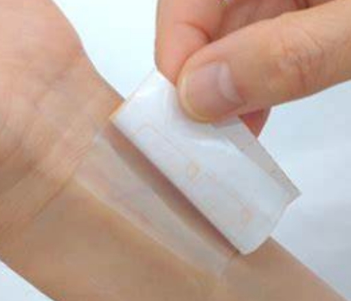 醫(yī)用粘合劑：無縫連接，安心治療——醫(yī)用粘合劑的種類與應用