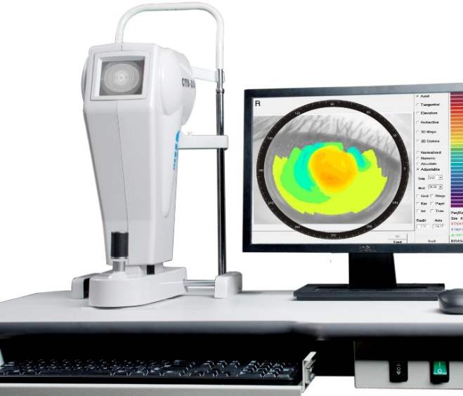 角膜地形圖儀：繪制角膜地圖，精確指導治療——角膜地形圖儀的功能詳解