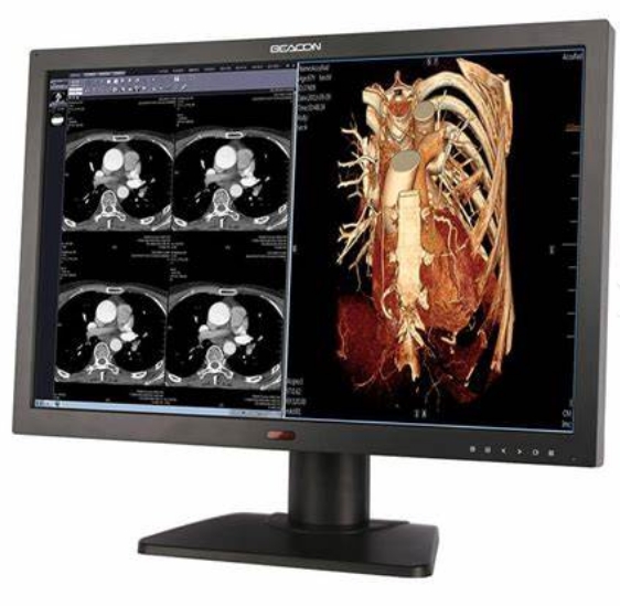 高清顯示，精確診斷——醫(yī)用顯示器的技術(shù)特點(diǎn)及其重要性