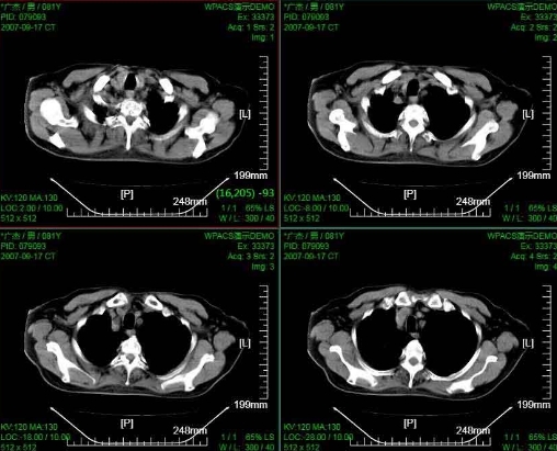 數(shù)字化影像管理——PACS系統(tǒng)如何優(yōu)化醫(yī)療圖像存儲(chǔ)與交流