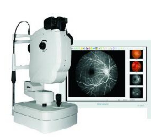 眼底熒光造影機