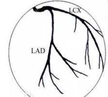 冠狀動(dòng)脈造影系統(tǒng)