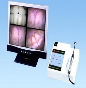 口腔內(nèi)窺鏡