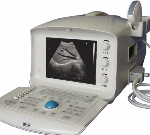 超聲診斷儀?